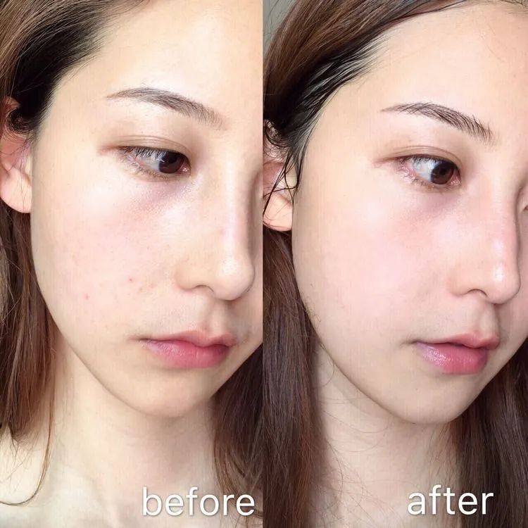 芦荟胶还能这样用?去红维稳,修复肌肤屏障,用完肌肤比豆腐还嫩