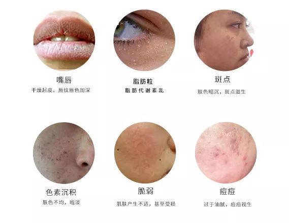 氨基酸温和净透卸妆水,obo玻尿酸卸妆水500ml