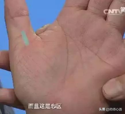 手上的健康秘密,手的颜色能看出健康的问题吗