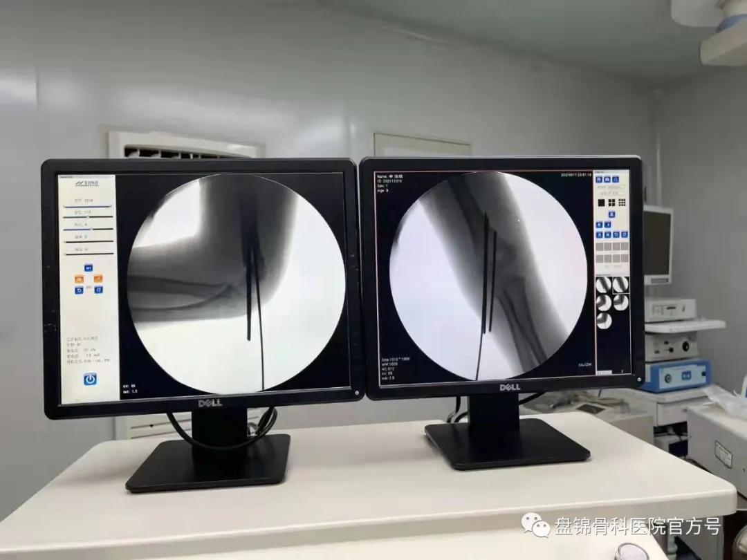 大手牵小手暖童心,大手牵小手温暖人心