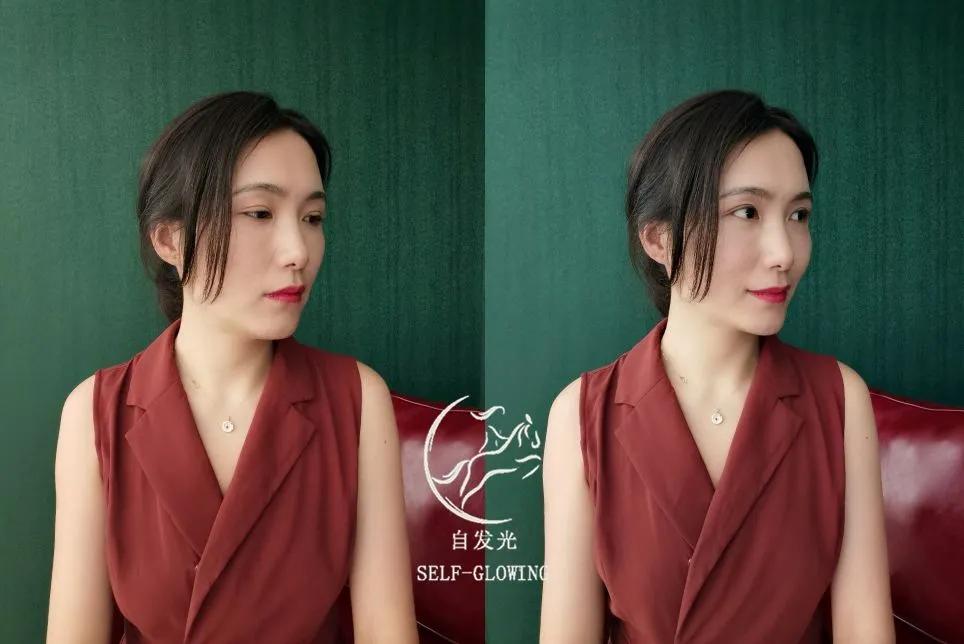 抗衰老预防垮脸,抗皱抗衰去细纹有哪些