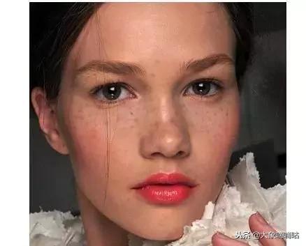 土豆片祛斑淡斑有奇效,淡斑祛斑护肤品或精油