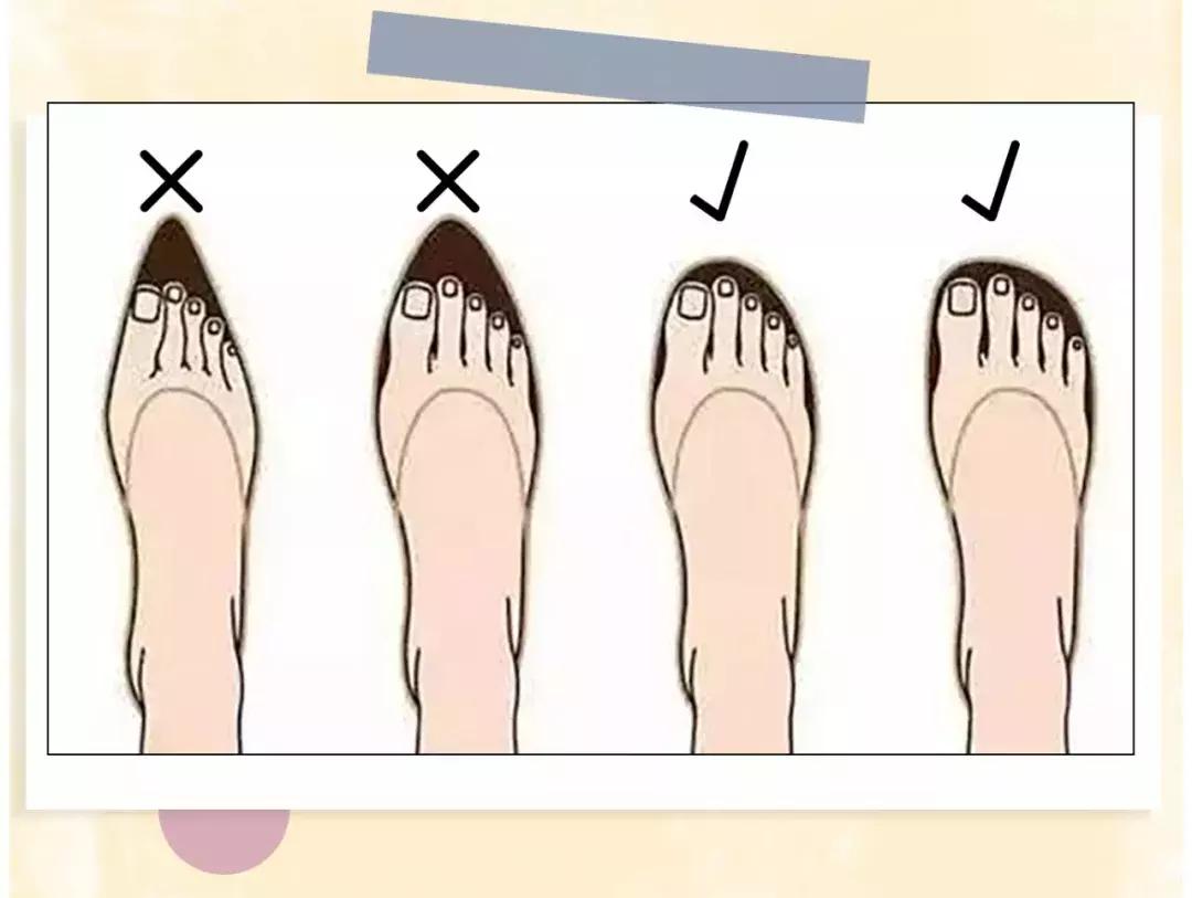脚短脚宽如何选鞋子,脚小但是脚板宽怎么选高跟鞋