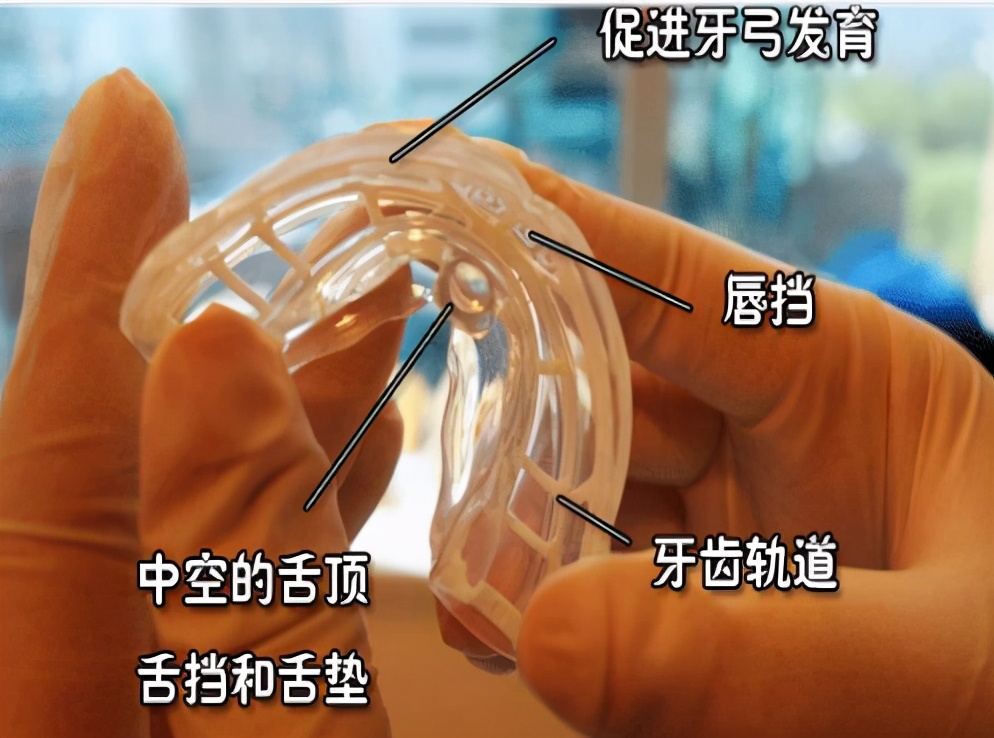 mrc矫正器小孩子晚上不愿意咬,mrc儿童牙齿矫正