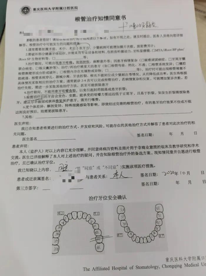 门牙根管治疗一位良心牙医的忠告,乳牙根管治疗一位良心牙医的忠告