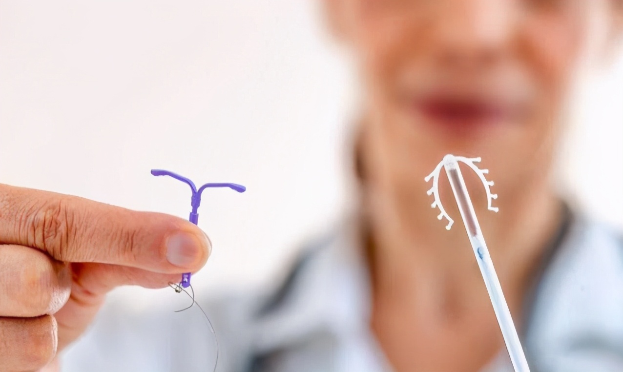 节育环必须取出吗什么时候取好,五十岁节育环取还是不取好