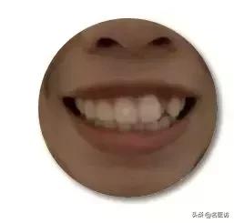 矫正牙齿后牙掉了,矫正牙齿只拔上面2颗牙