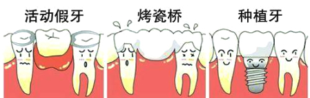 缺牙对寿命有影响吗,99%的人都不知道健康有多重要