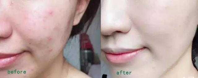 沈梦辰肤色多黑,沈梦辰为什么黑皮肤能化妆变白