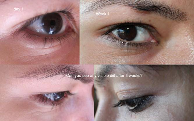 保湿眼霜推荐10款,18岁天生黑眼圈眼袋眼霜推荐平价