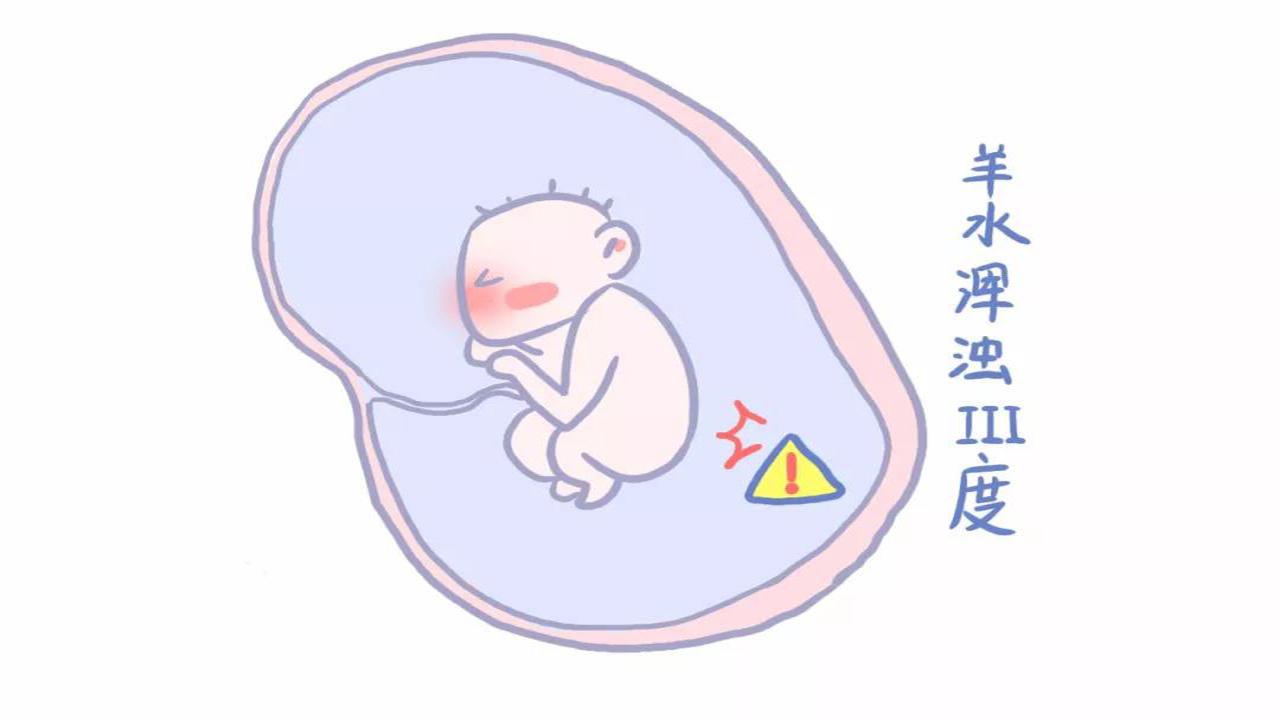 孕妇羊水浑浊导致缺氧,羊水浑浊为什么会导致胎儿缺氧