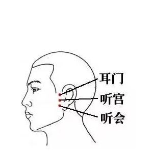 十大实用针灸穴位,针灸特殊穴位主治歌诀