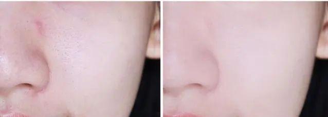 泽美皮肤暗沉,泽美护肤步骤