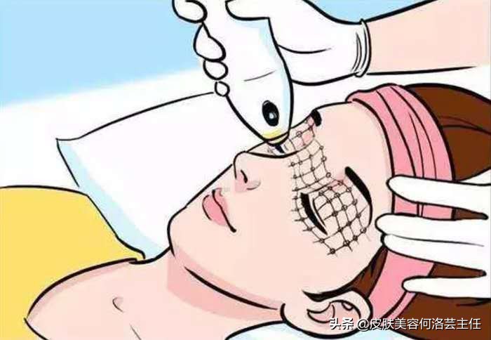 热玛吉有必要做么,热玛吉适用于什么人群