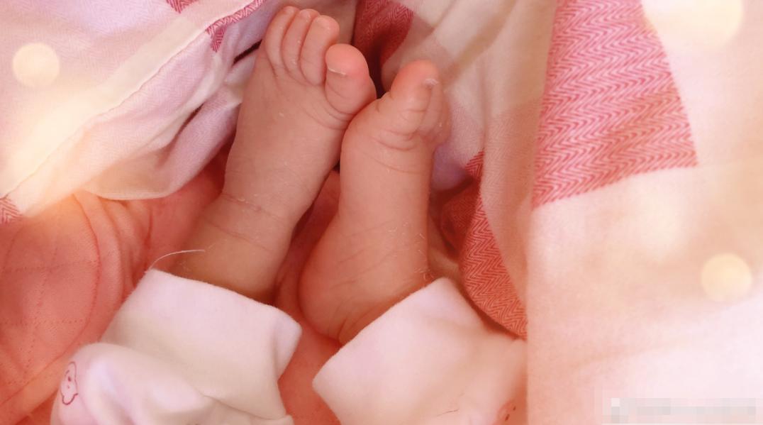 新生儿出现脱皮,新生儿34天脱发正确方法