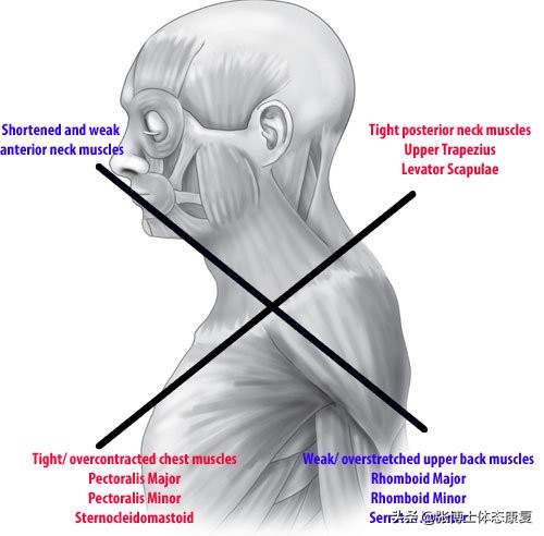体态矫正有哪些坑,体态矫正开始难受