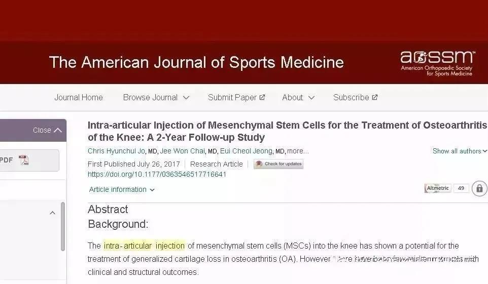 干细胞治疗关节炎个人感受,关节的干细胞治疗过程和原理