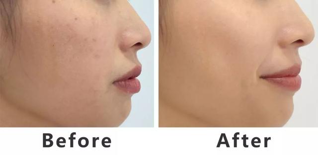 张嘉倪推荐的高端精华液,张嘉倪最好用的水