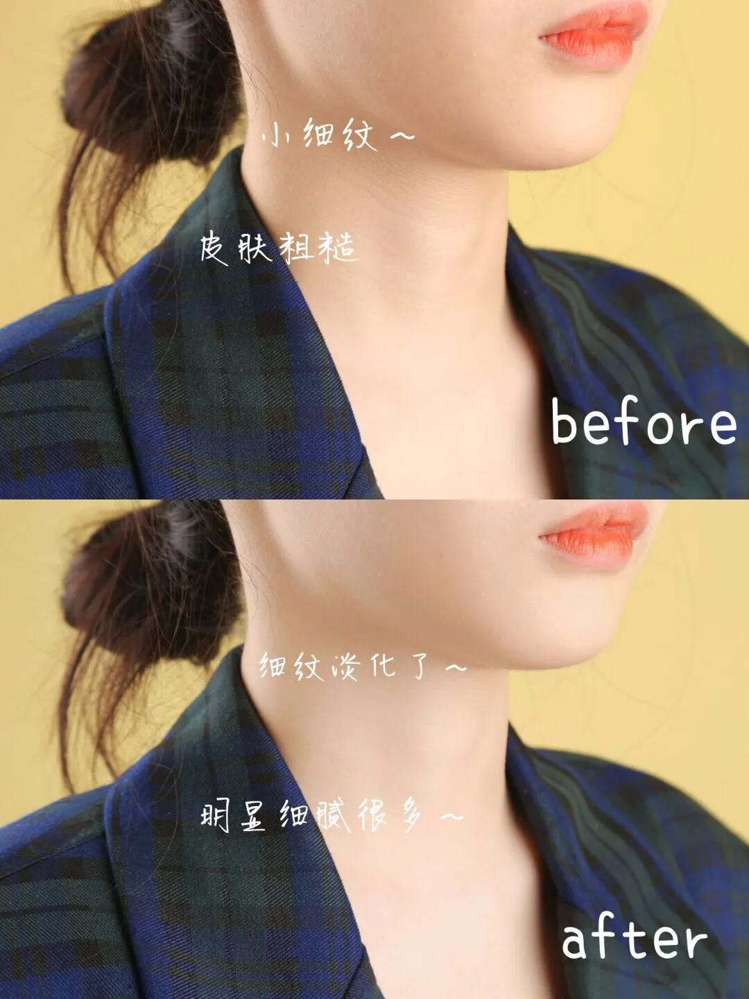 怎么磨皮去颈纹,平价去颈纹颈霜推荐