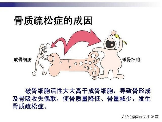 50岁的女性更年期有什么症状,女人50岁为什么会有疼痛症状呢