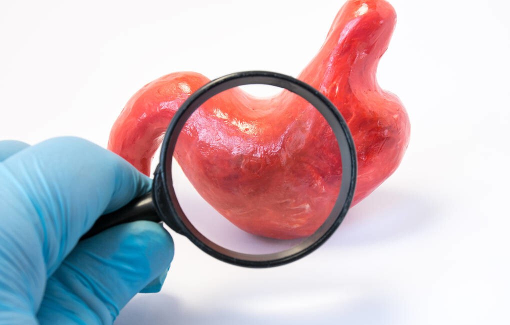 什么样的胃痛是心脏病,哪些情况属于胃痛