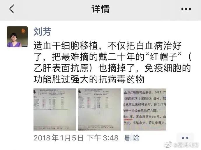 乙肝干细胞移植,乙肝干细胞移植有用吗