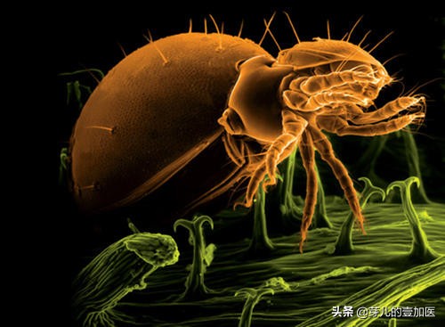 有蜱虫咬的人怎么处理,为什么有人被蜱虫咬也没事