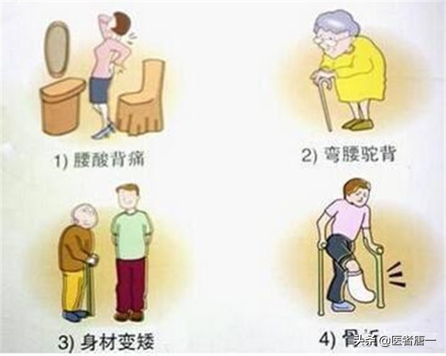 50岁严重的骨质疏松怎么办,女性50岁补钙什么牌子最好