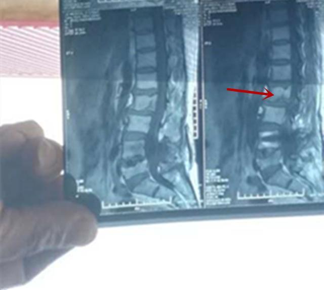 姐夫把小舅子车撞了一下怎么办,小姨子开车撞姐夫保险赔吗
