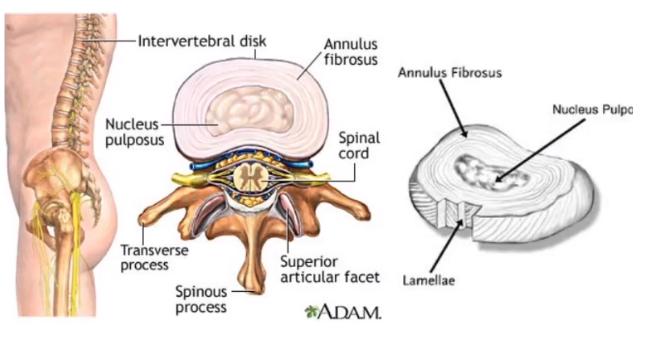 腰疼椎管狭窄压迫神经怎么治疗,腰疼椎管狭窄有什么办法
