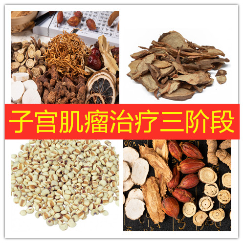 查出子宫有小肌瘤注意什么饮食,子宫肌瘤的四个常用诊断方法