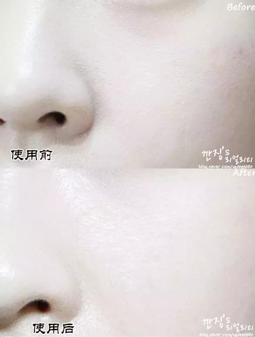 欧阳娜娜安利的能量棒,欧阳娜娜祛痘膏多少钱