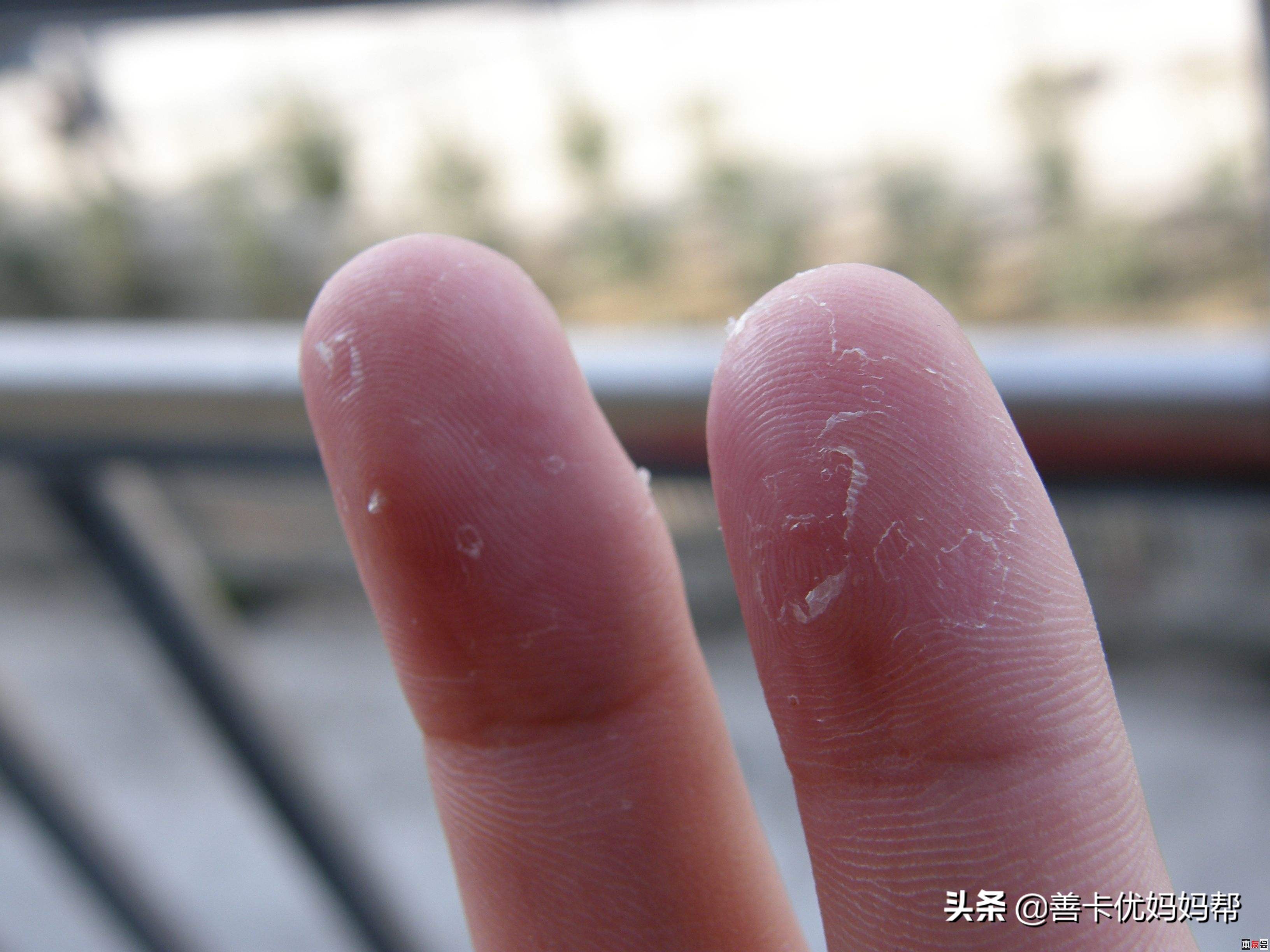 善卡优儿童维生素d,善卡优钙适合多大宝宝吃