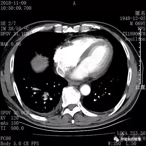 怎么应用统计学做调查,统计学方法可以解决的主要问题