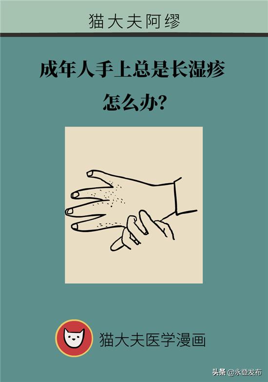 湿疹膏有哪些治疗效果好的,湿疹膏可以治愈吗