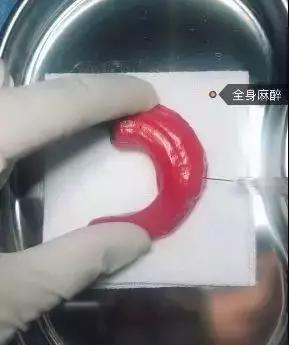 香蕉割包皮，洋葱剖腹产？这是我见过最秀的医生