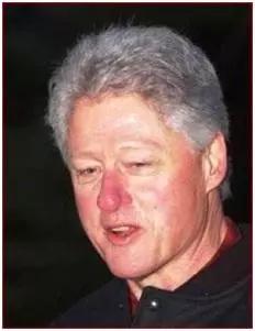 甲硝唑凝胶祛黑头药店多少钱一支,甲硝唑去黑头凝胶正版