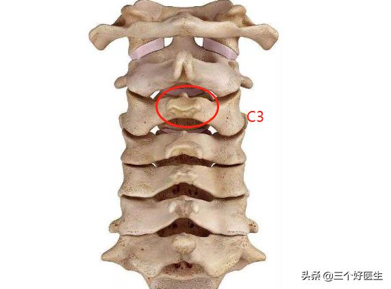 颈椎脊椎的精确定位及触诊技巧,脊椎三步定位图解