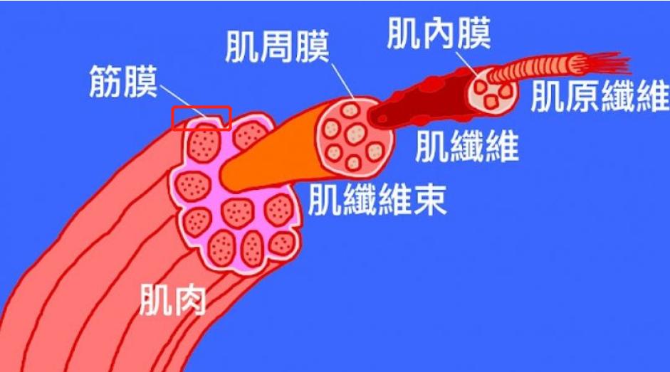 有种伤不起的痛叫筋膜炎,筋膜炎疼痛的原因和治疗方法