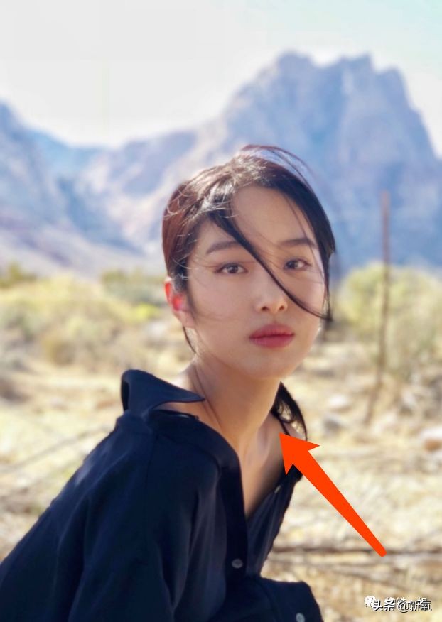 抢了刘亦菲干爹还发博踩天仙，但她这个部位肿得惊人