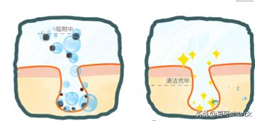 清洁面膜清洁毛孔的原理,夏可叔叔扒美白产品
