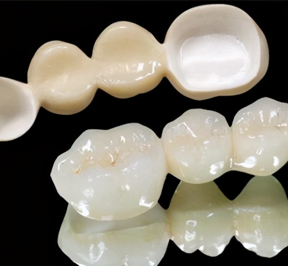 二氧化锆烤瓷牙分几个档次,二氧化锆烤瓷牙进口和国产区别