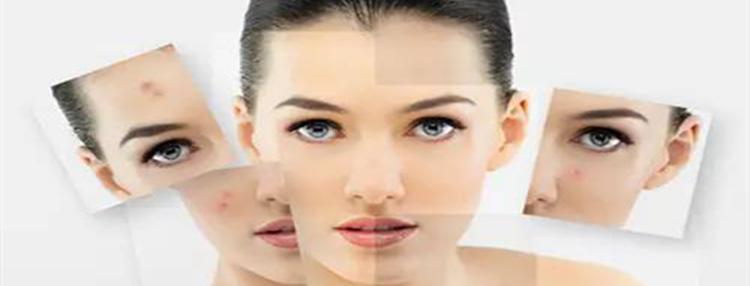 祛痘好方法更快更有效,祛痘最真实的方法