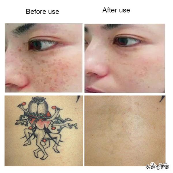 宋祖儿雀斑造型美到窒息,宋祖儿脸上的雀斑一清二楚