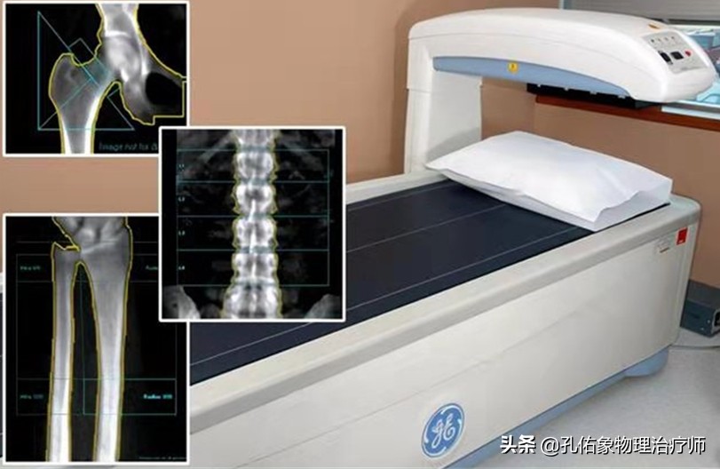 左肩胛骨有时胀痛麻是咋回事,更年期左侧肩胛骨疼是什么原因