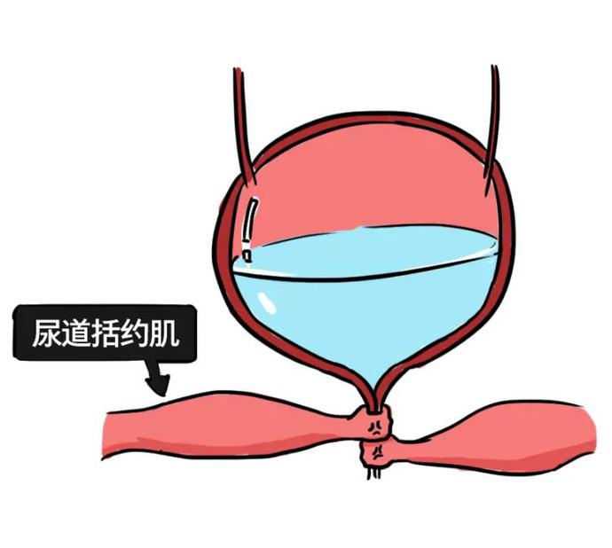 睡觉尿憋回去是怎么回事,憋回去的尿最终会从哪里排出来