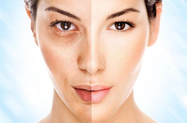 心真大！朋友圈买“肉毒素”，轻者嘴歪，重者致命……