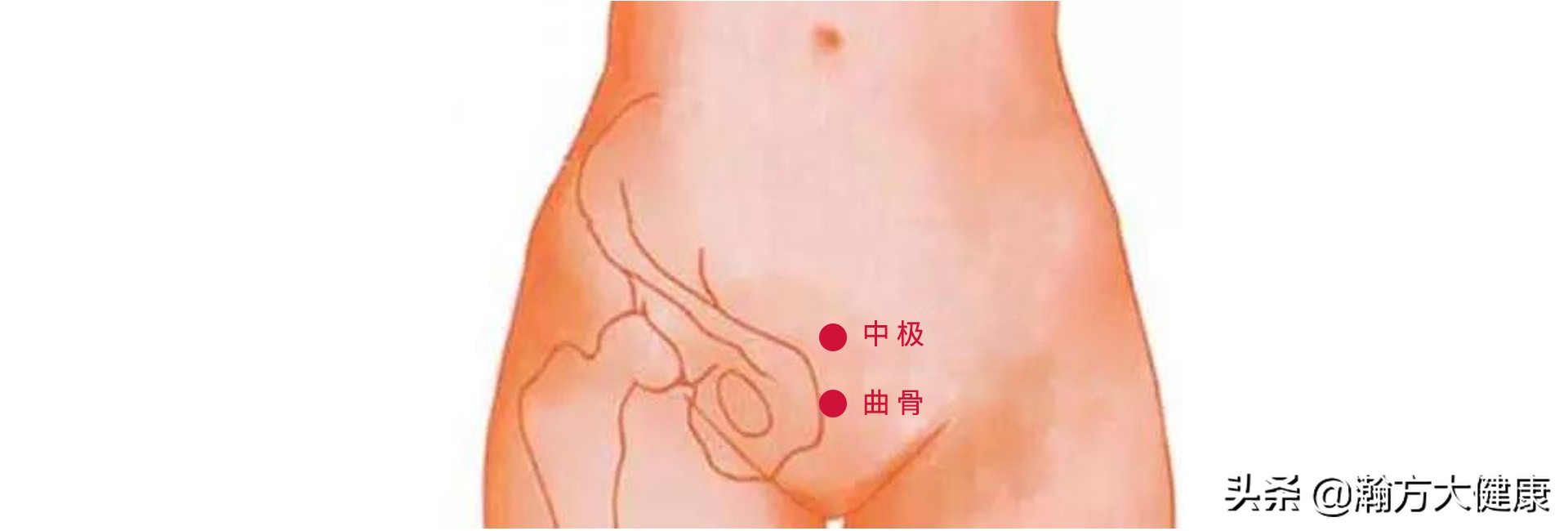 卵巢囊肿，中华天灸调理有方法！！！早调早效