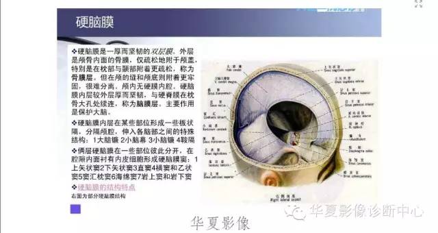 一文读懂颅内胆脂瘤,一文看懂背后的真相