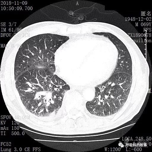 怎么应用统计学做调查,统计学方法可以解决的主要问题